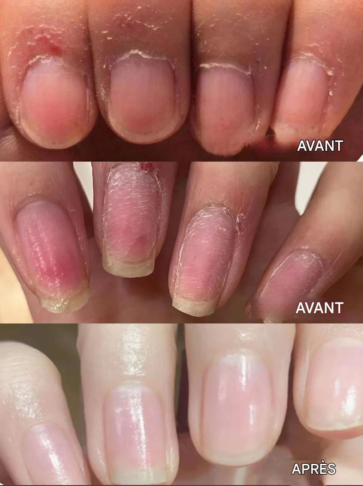💜2025 Nouveau stylo de soin des ongles 3 en 1 amélioré💅