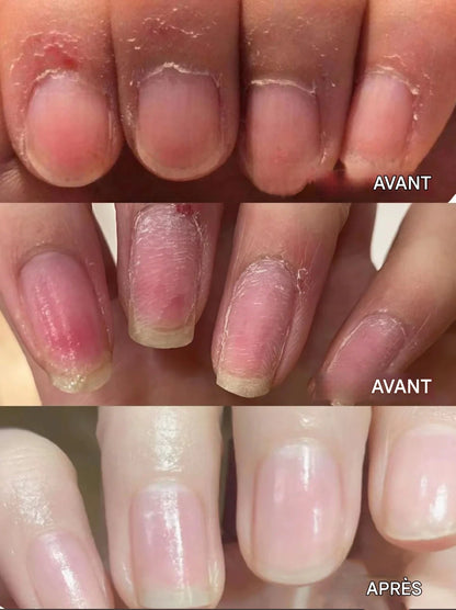 💜2025 Nouveau stylo de soin des ongles 3 en 1 amélioré💅